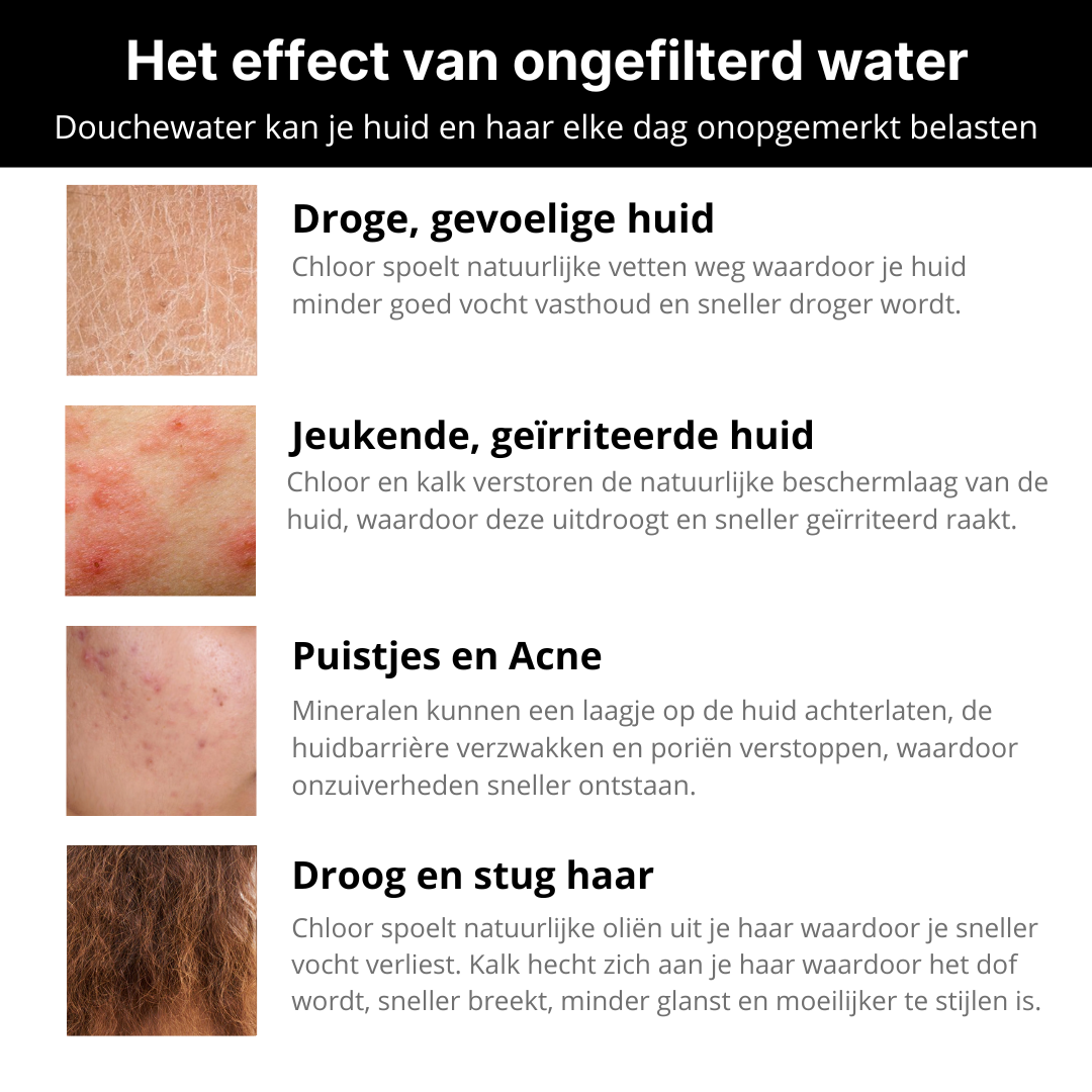 Alutura Gefilterde Douchekop ™